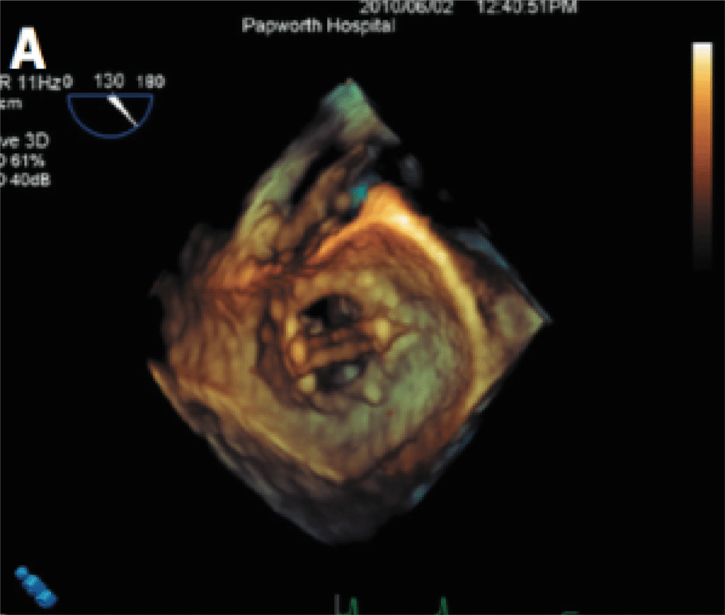 Diagnostic services - Stress Testing