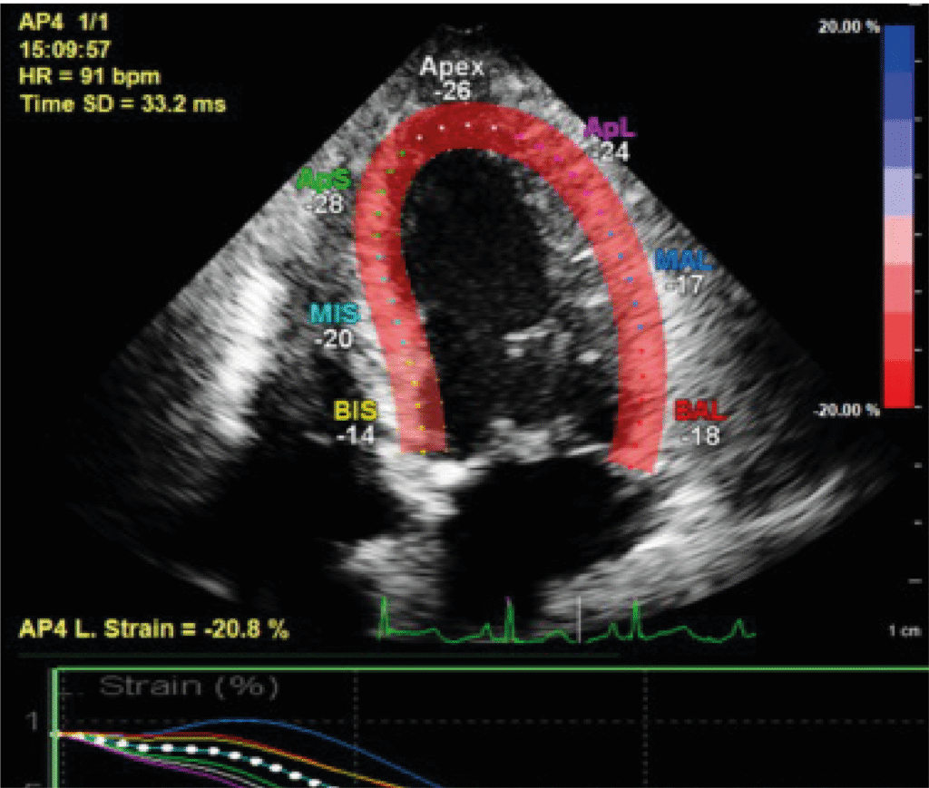 Diagnostic services - Holter Monitoring