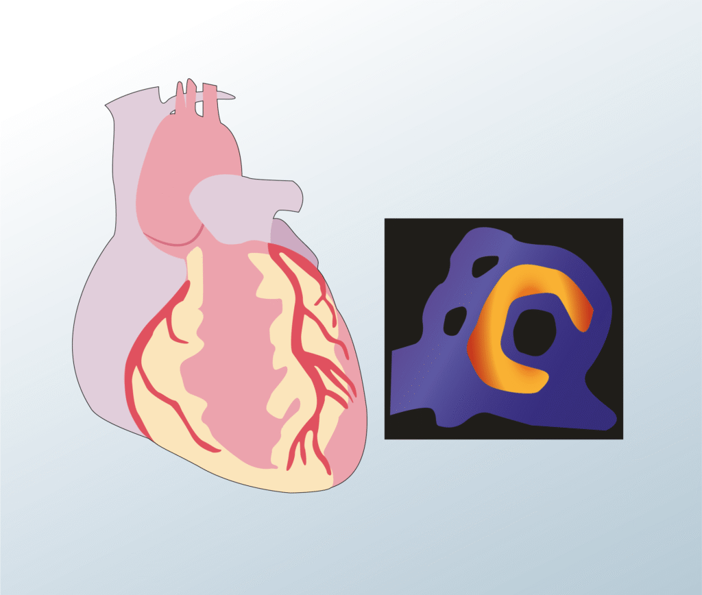 Diagnostic services - Ambulatory BP monitoring
