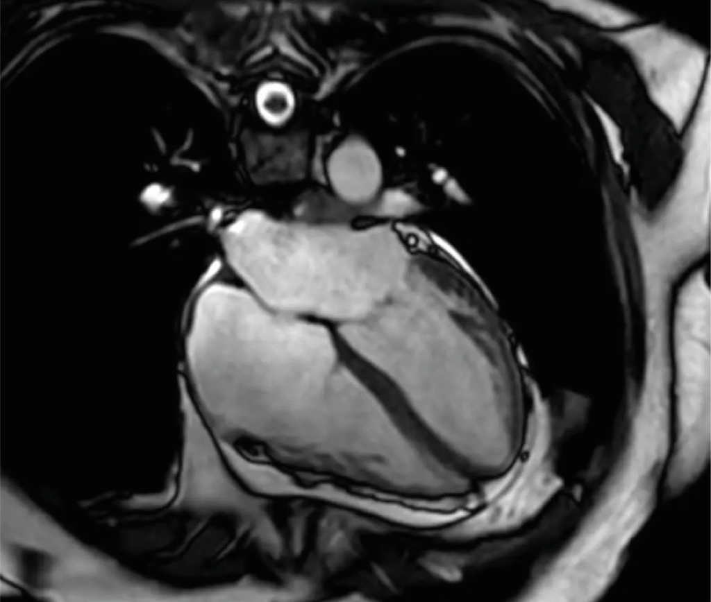 Diagnostic services - Advanced cardiac imaging