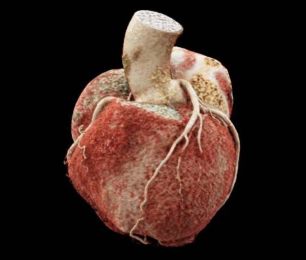 1150 Slice CT Scan machine at Ruby Hall Clinic