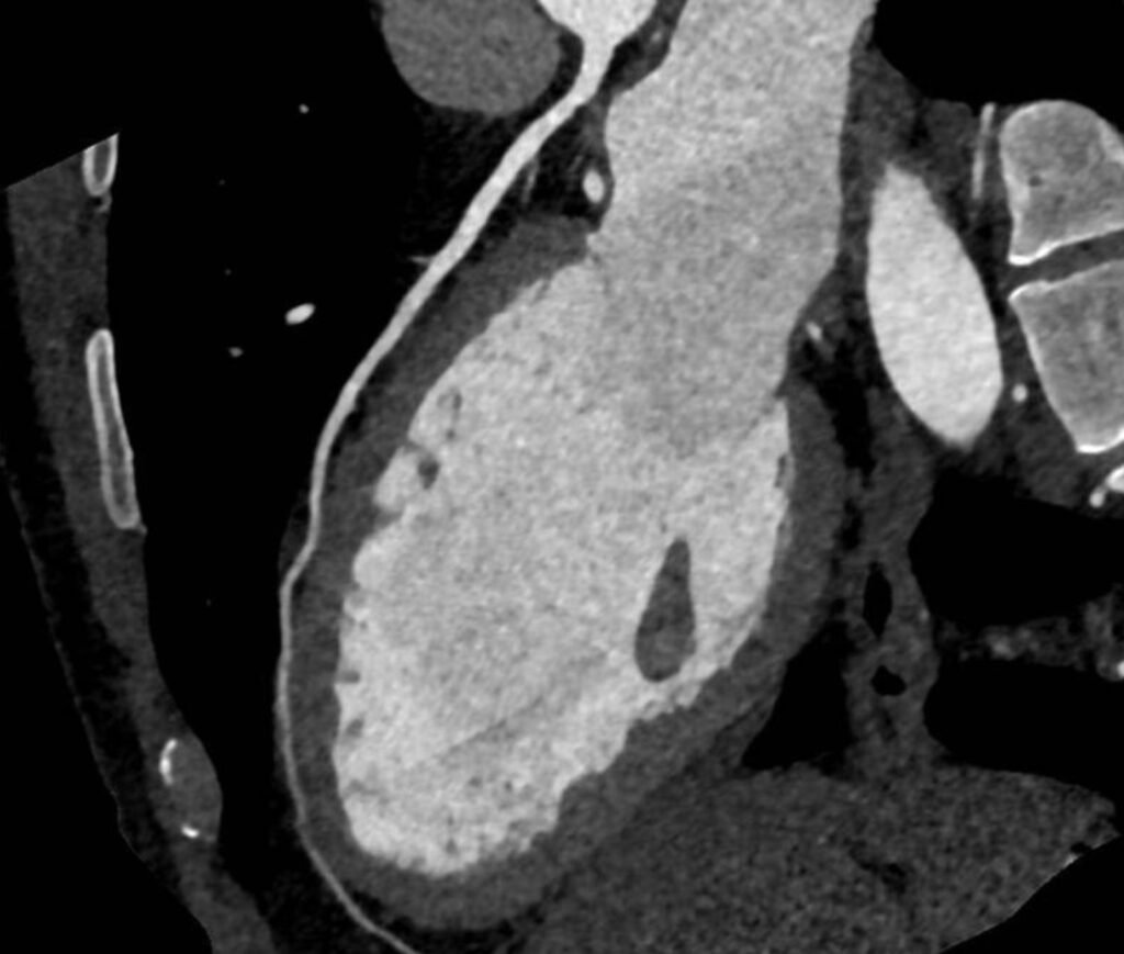 Cardiac PET Scan at Ruby Hall Clinic